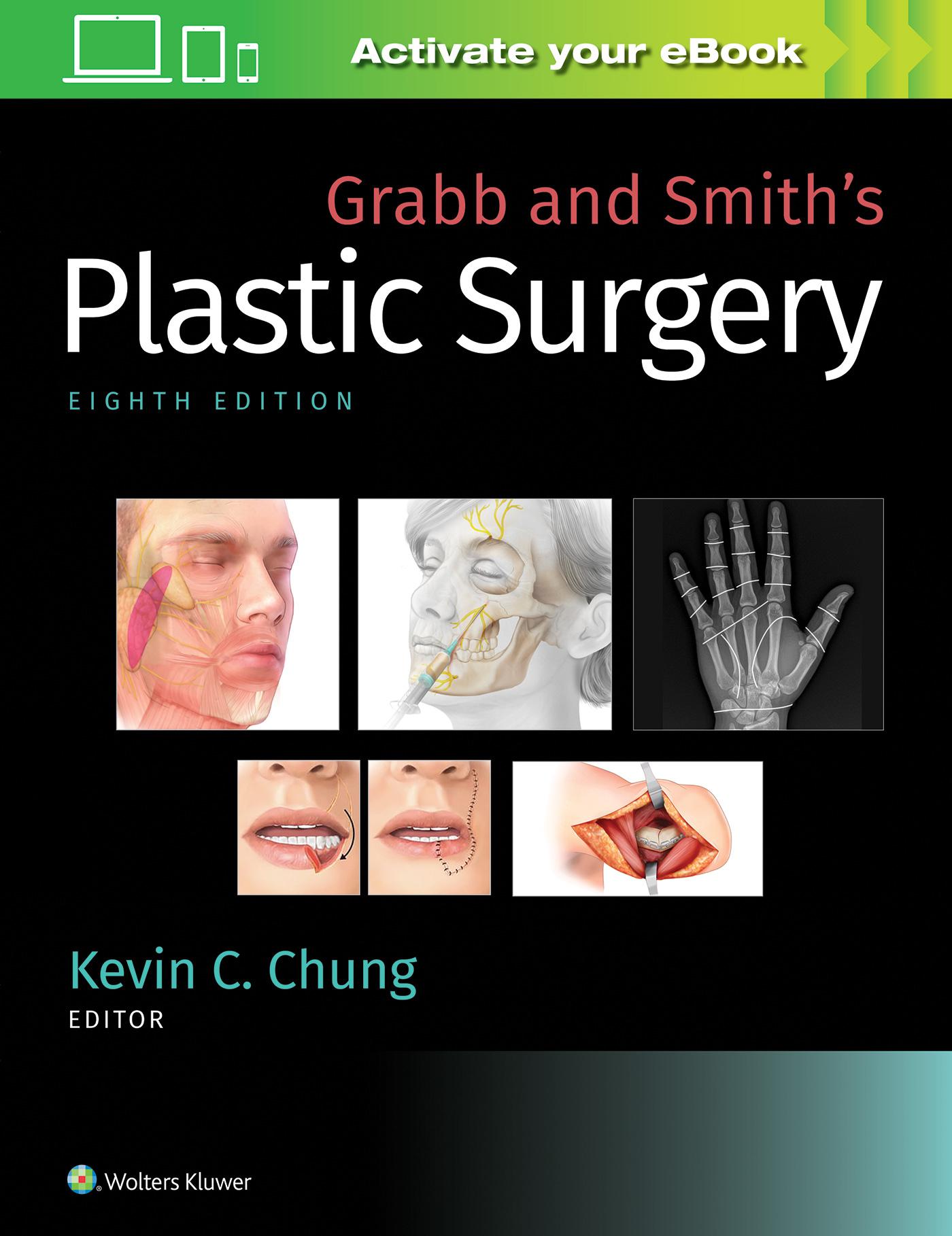 Cover: 9781496388247 | Grabb and Smith's Plastic Surgery | Kevin Chung | Buch | Gebunden