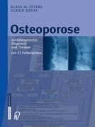 Cover: 9783798514652 | Osteoporose | Ulrich Deuß (u. a.) | Buch | HC runder Rücken kaschiert