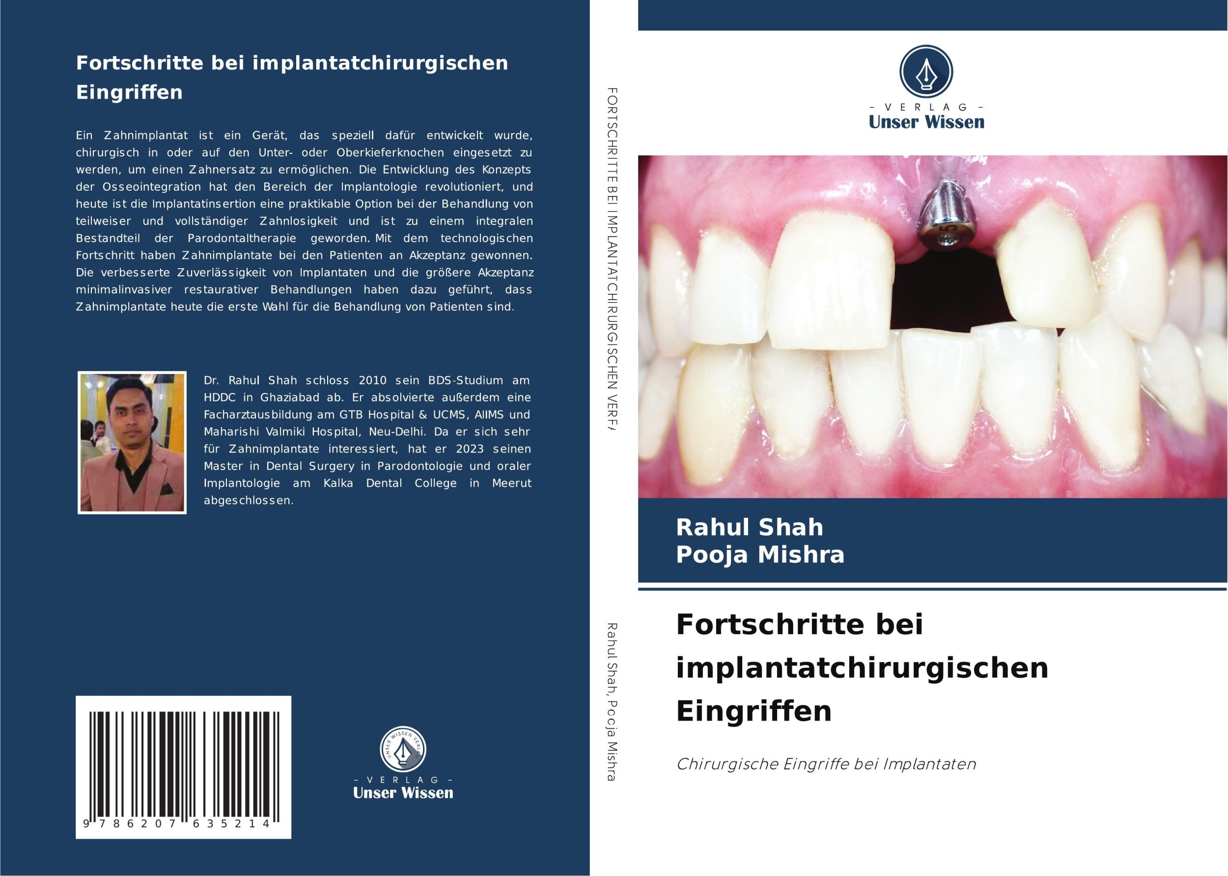 Cover: 9786207635214 | Fortschritte bei implantatchirurgischen Eingriffen | Shah (u. a.)