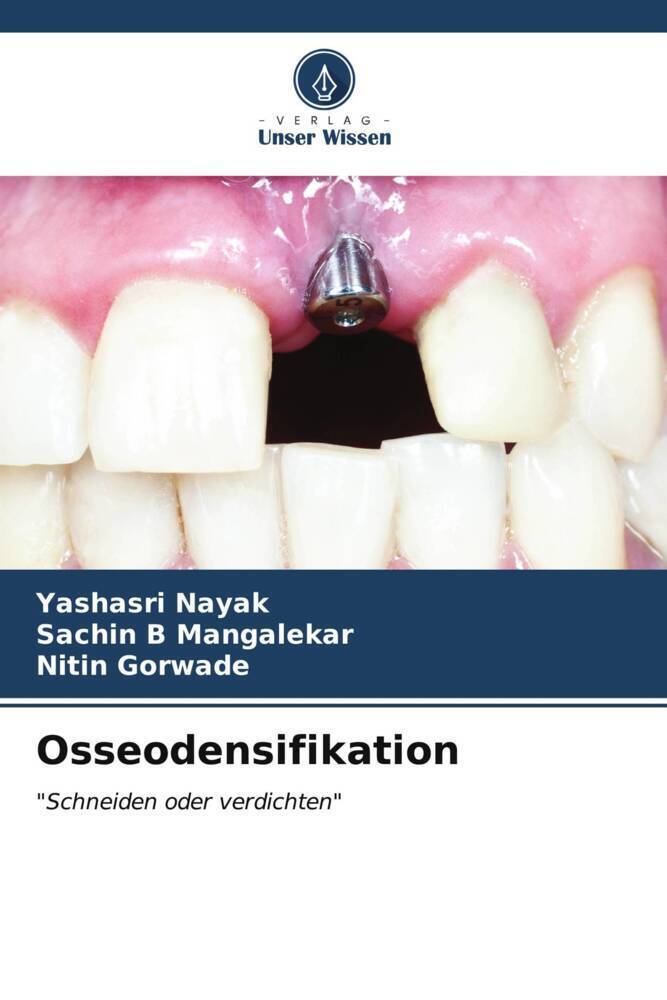 Cover: 9786206892915 | Osseodensifikation | "Schneiden oder verdichten" | Nayak (u. a.)