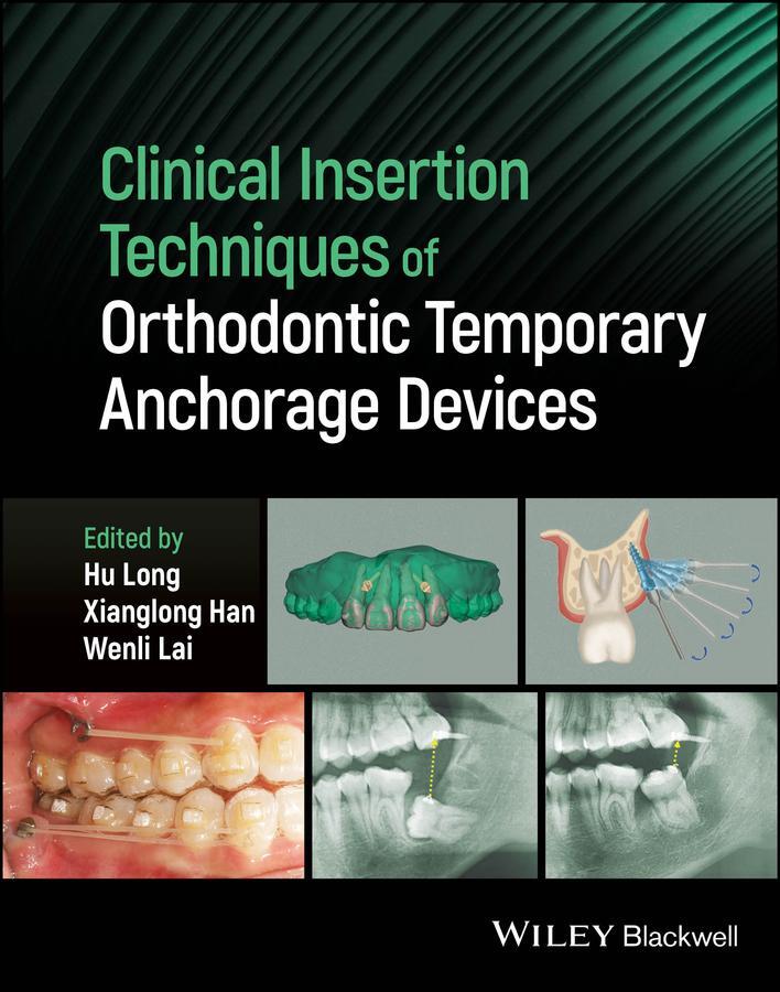 Cover: 9781119892236 | Clinical Insertion Techniques of Orthodontic Temporary Anchorage...