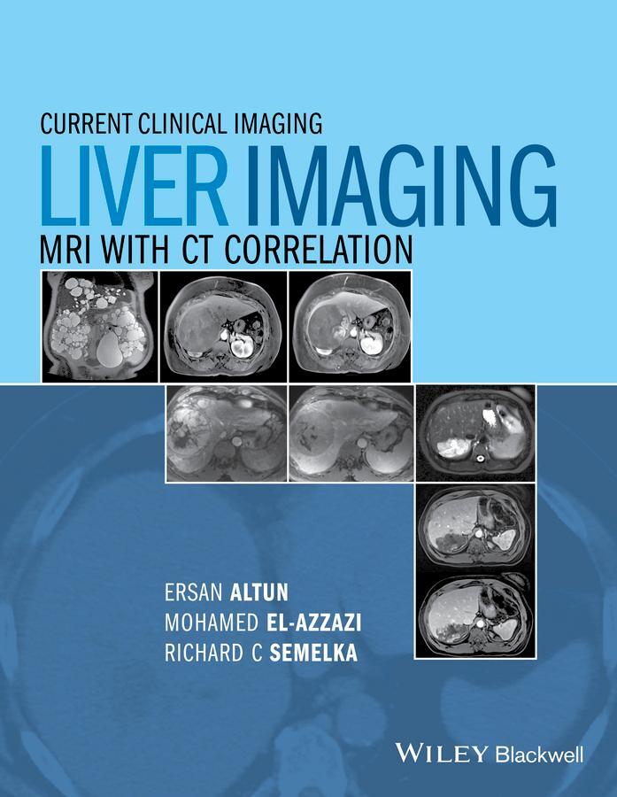 Cover: 9780470906255 | Liver Imaging | MRI with CT Correlation | Ersan Altun (u. a.) | Buch