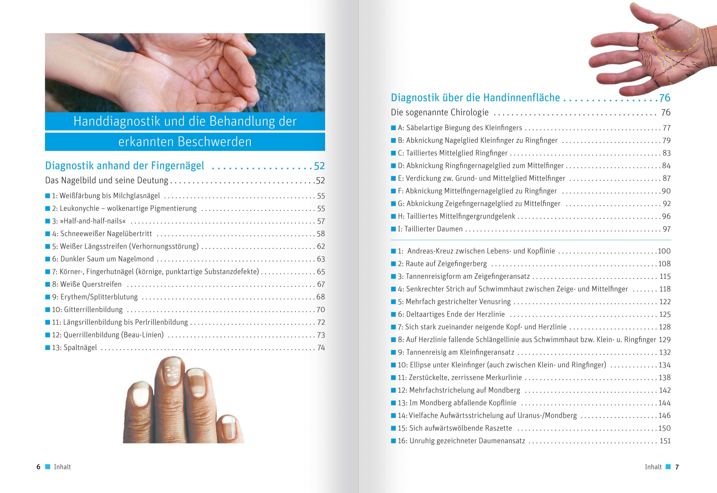 Bild: 9783863744557 | Schüßler-Salze - Gesichts- und Handdiagnostik | Reichenberg | Buch