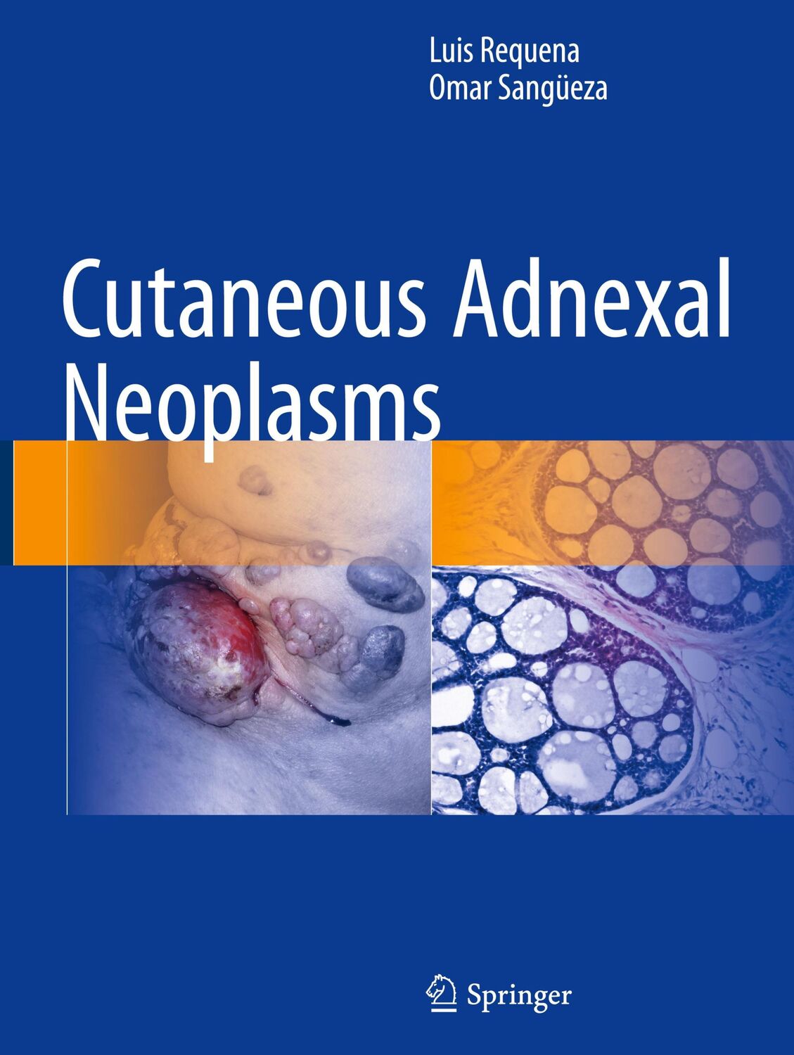 Cover: 9783319457031 | Cutaneous Adnexal Neoplasms | Luis Requena (u. a.) | Buch | xxiii