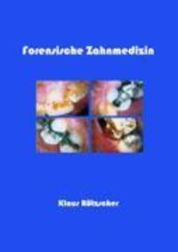 Cover: 9783833403729 | Forensische Zahnmedizin | Klaus Rötzscher | Taschenbuch | Paperback