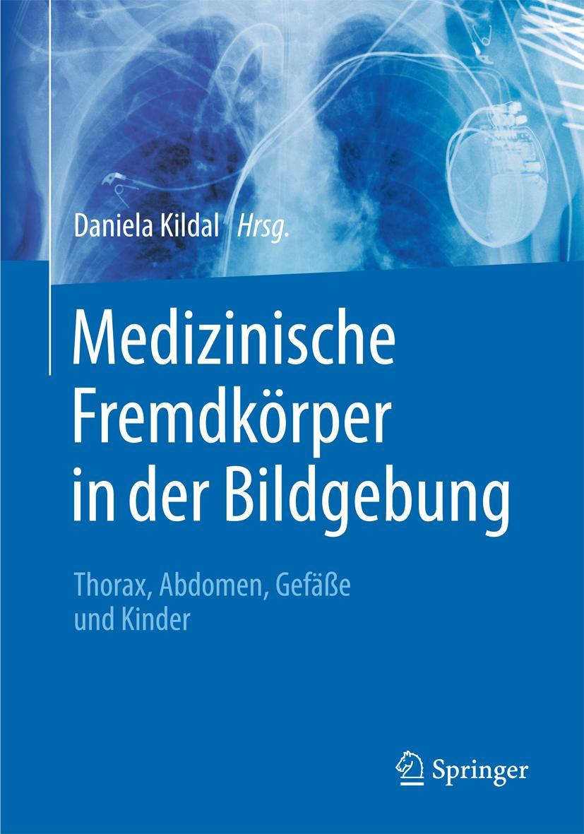 Cover: 9783662472958 | Medizinische Fremdkörper in der Bildgebung | Daniela Kildal | Buch