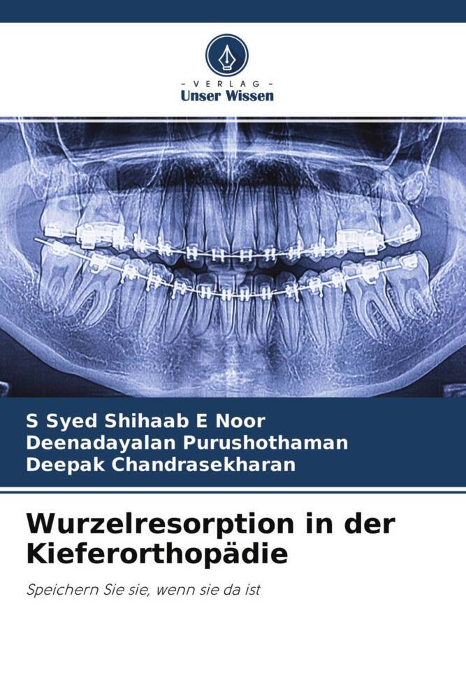 Cover: 9786204519364 | Wurzelresorption in der Kieferorthopädie | Noor (u. a.) | Taschenbuch