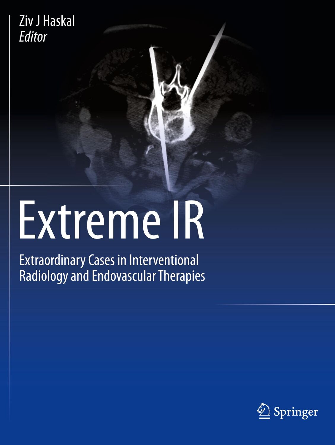 Cover: 9783031242533 | Extreme IR | Ziv J Haskal | Taschenbuch | Paperback | xxiv | Englisch