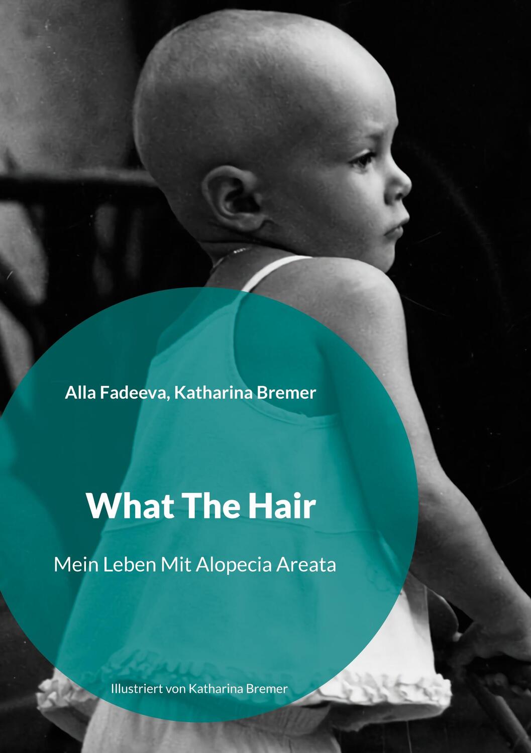 Cover: 9783749448012 | What The Hair | Mein Leben Mit Alopecia Areata | Alla Fadeeva (u. a.)