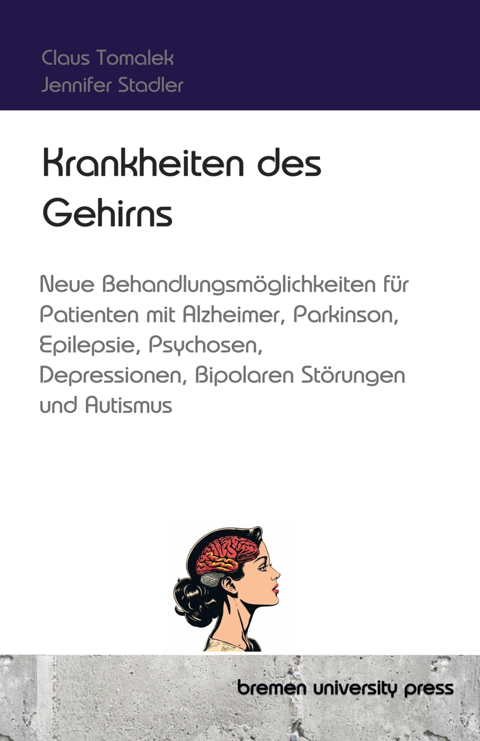 Cover: 9783689044534 | Krankheiten des Gehirns | Claus Tomalek | Taschenbuch | Paperback