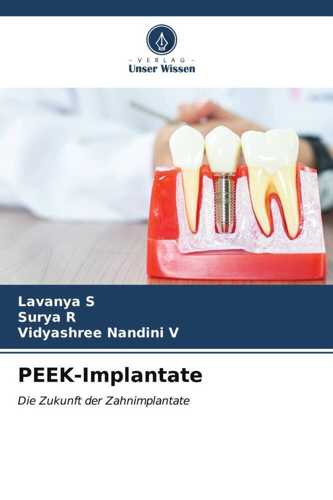 Cover: 9786206944638 | PEEK-Implantate | Die Zukunft der Zahnimplantate | Lavanya S (u. a.)