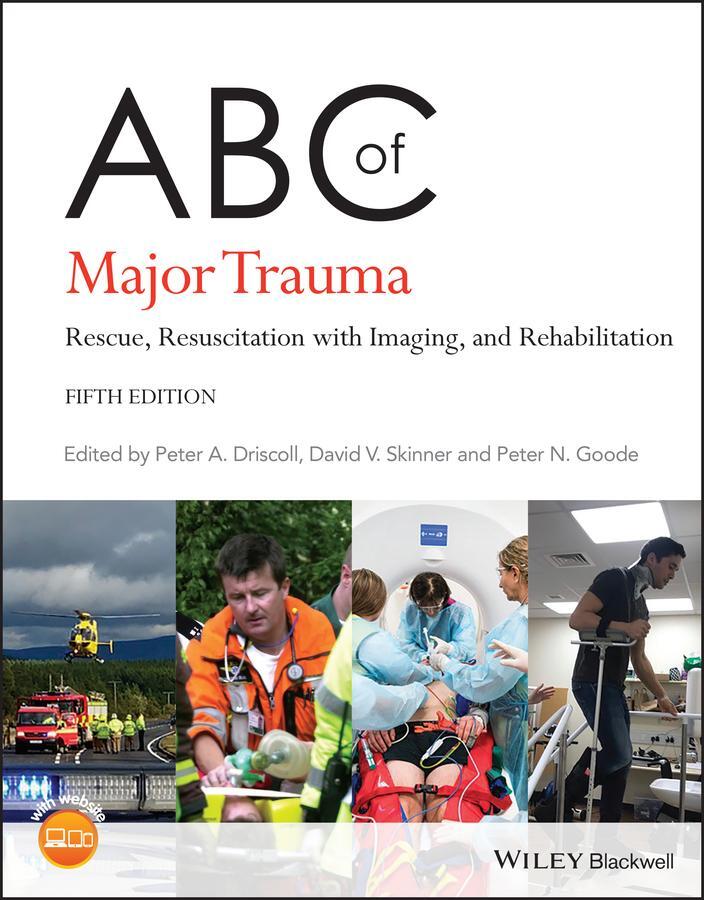 Cover: 9781119498858 | ABC of Major Trauma | David V. Skinner (u. a.) | Taschenbuch | 496 S.