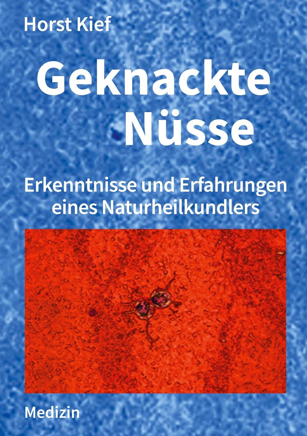 Cover: 9783754302163 | Geknackte Nüsse | Erkenntnisse und Erfahrungen eines Naturheilkundlers