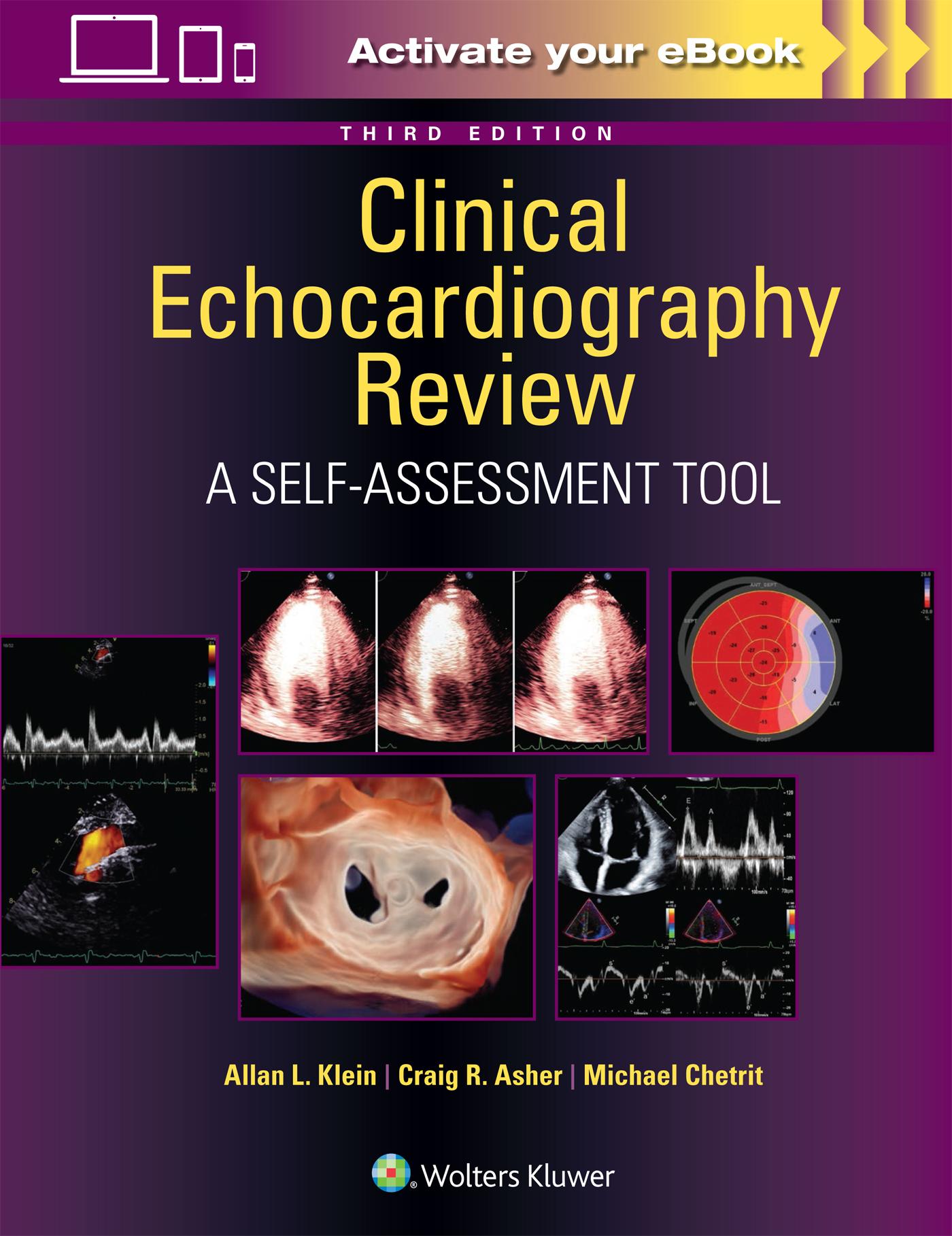 Cover: 9781975211899 | Clinical Echocardiography Review | Allan L Klein (u. a.) | Taschenbuch