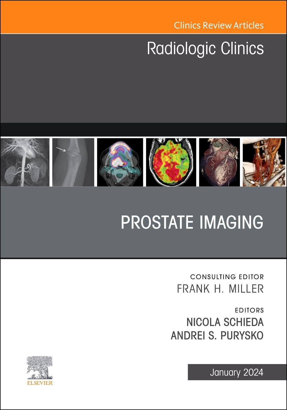 Cover: 9780443183560 | Prostate Imaging, an Issue of Radiologic Clinics of North America