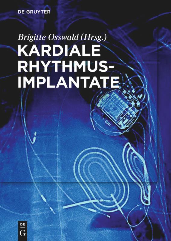 Cover: 9783110440461 | Kardiale Rhythmusimplantate | Brigitte Osswald | Taschenbuch | XX