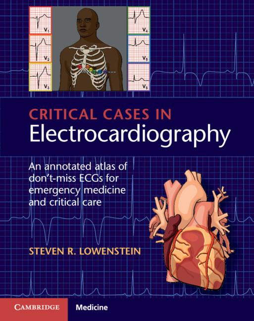 Cover: 9781107535916 | Critical Cases in Electrocardiography | Steven R. Lowenstein | Buch