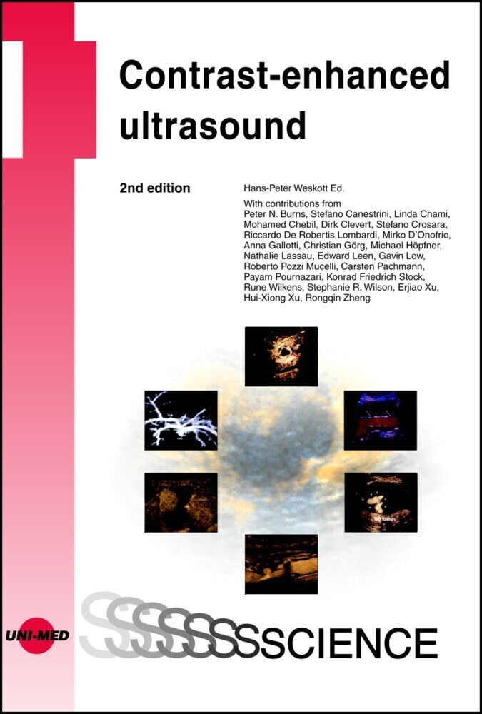 Cover: 9783837414288 | Contrast-enhanced ultrasound | Hans-Peter Weskott | Buch | 240 S.