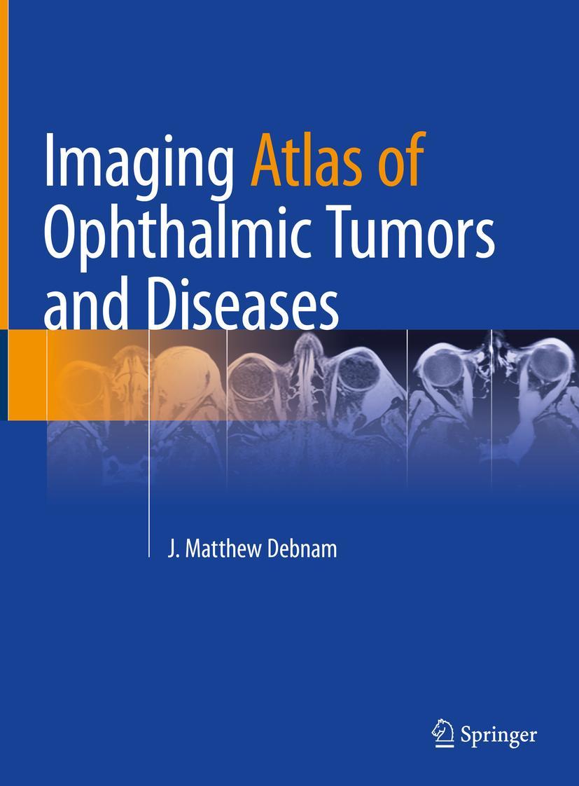 Cover: 9783031174780 | Imaging Atlas of Ophthalmic Tumors and Diseases | J. Matthew Debnam