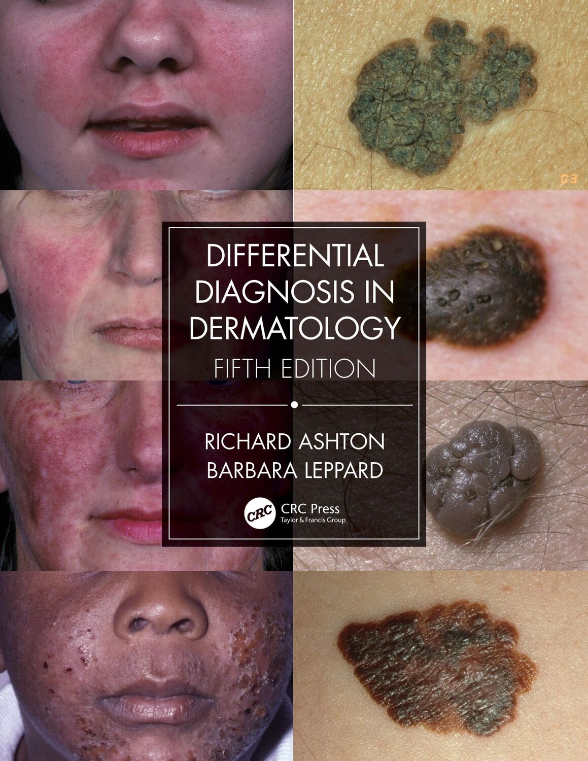 Cover: 9780367085971 | Differential Diagnosis in Dermatology | Barbara Leppard (u. a.) | Buch