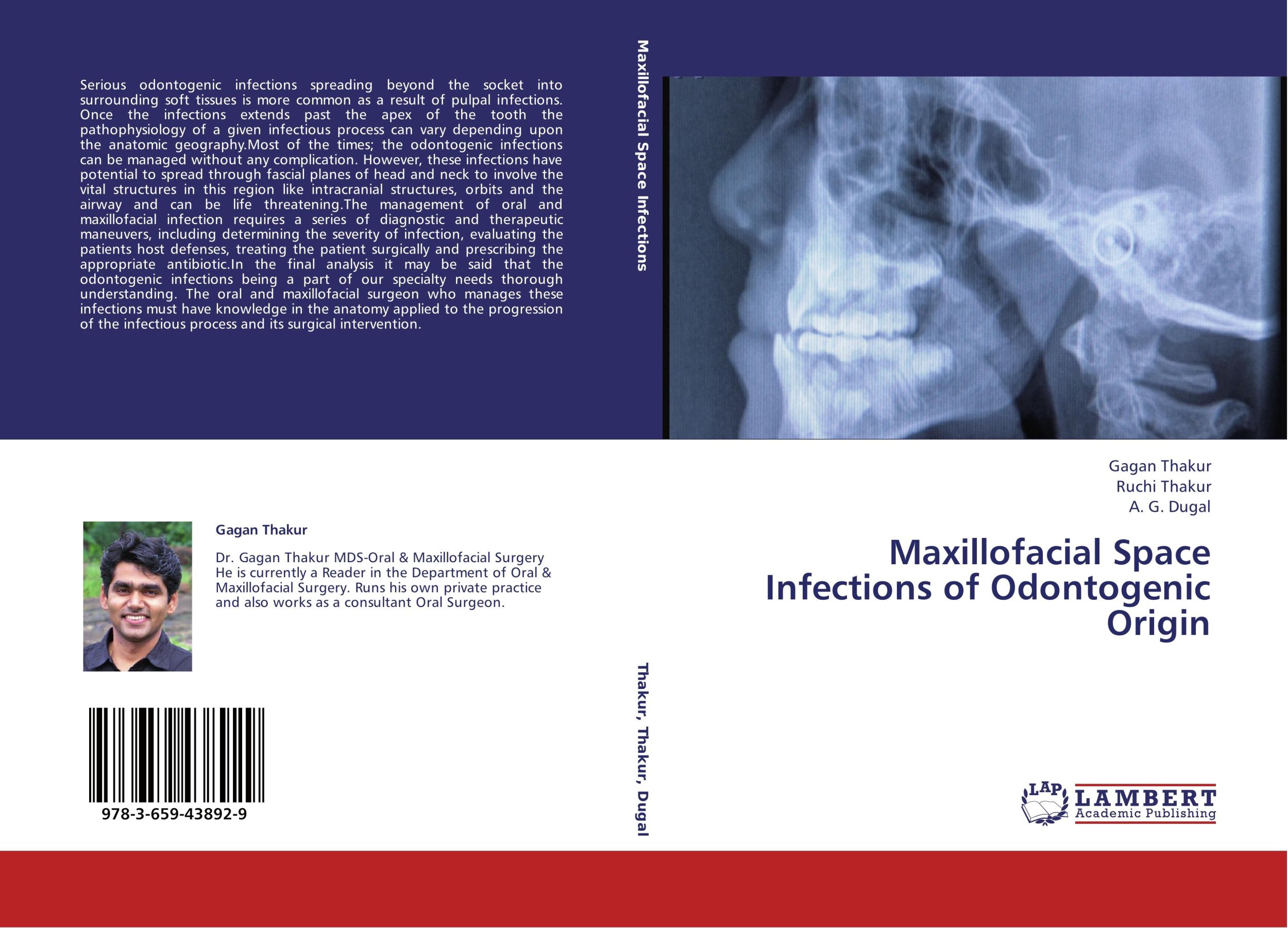 Cover: 9783659438929 | Maxillofacial Space Infections of Odontogenic Origin | Thakur (u. a.)