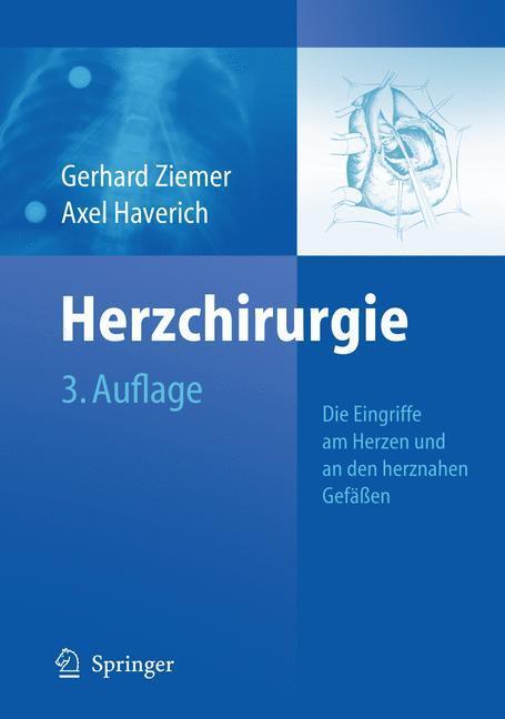 Cover: 9783540797128 | Herzchirurgie | Die Eingriffe am Herzen und an den herznahen Gefäßen