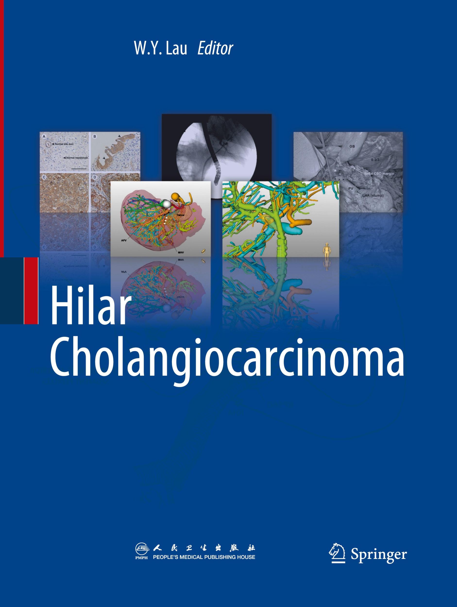 Cover: 9789401781718 | Hilar Cholangiocarcinoma | W. Y. Lau | Taschenbuch | Paperback | xvi