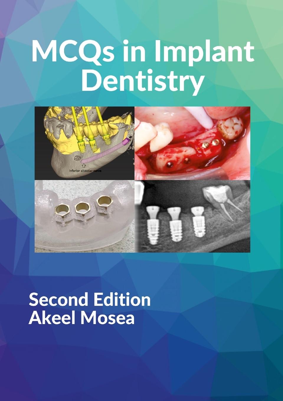 Cover: 9781326883195 | MCQs in Implant Dentistry | Akeel Mosea | Taschenbuch | Englisch