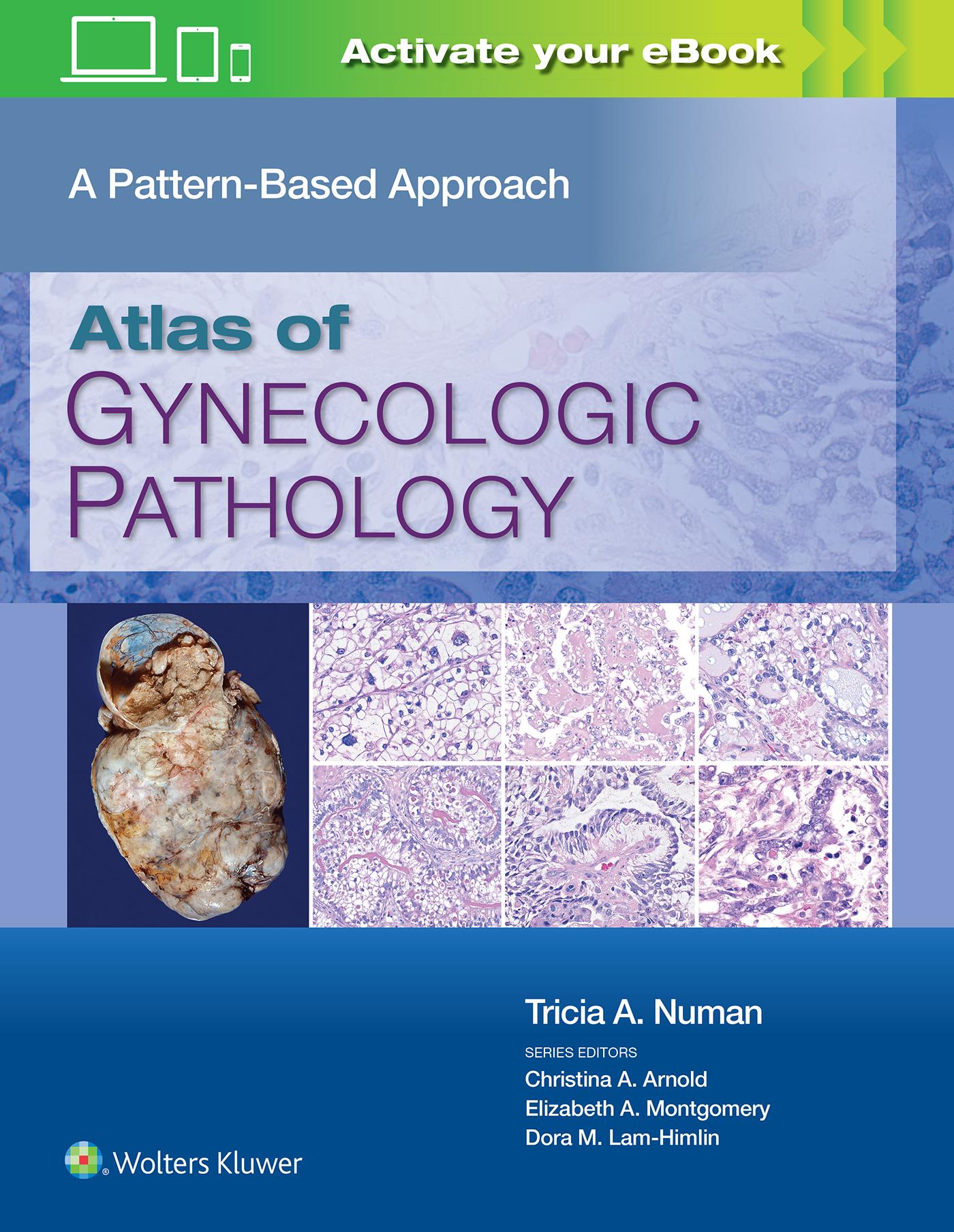 Cover: 9781975124762 | Atlas of Gynecologic Pathology | Tricia A. Numan | Buch | Gebunden