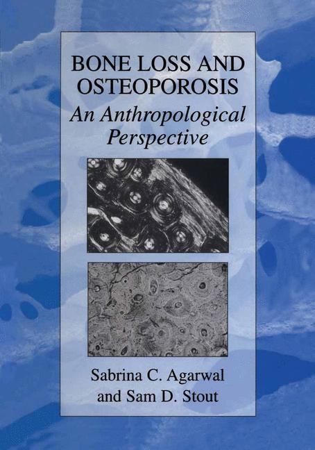 Cover: 9780306477676 | Bone Loss and Osteoporosis | An Anthropological Perspective | Buch