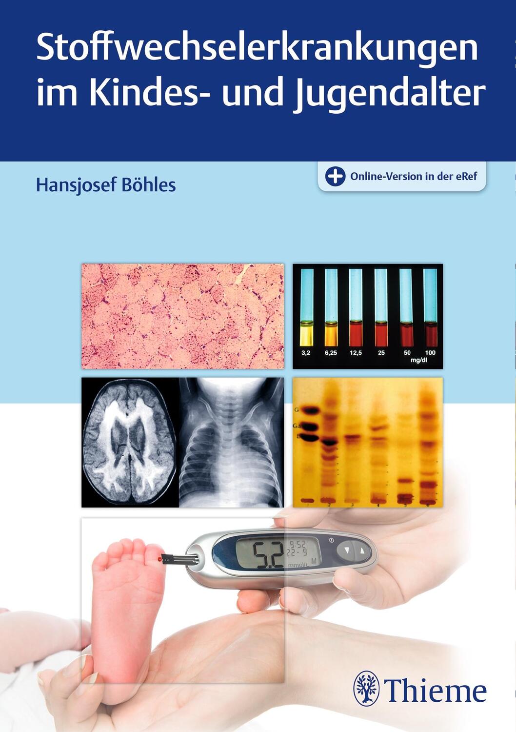 Cover: 9783132007215 | Stoffwechselerkrankungen im Kindes- und Jugendalter | Hansjosef Böhles