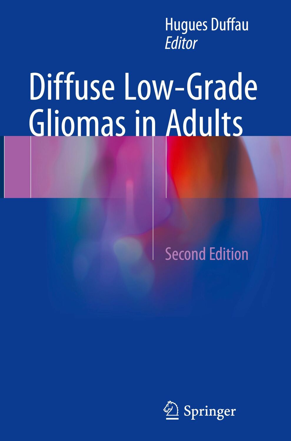 Cover: 9783319554648 | Diffuse Low-Grade Gliomas in Adults | Hugues Duffau | Buch | x | 2017