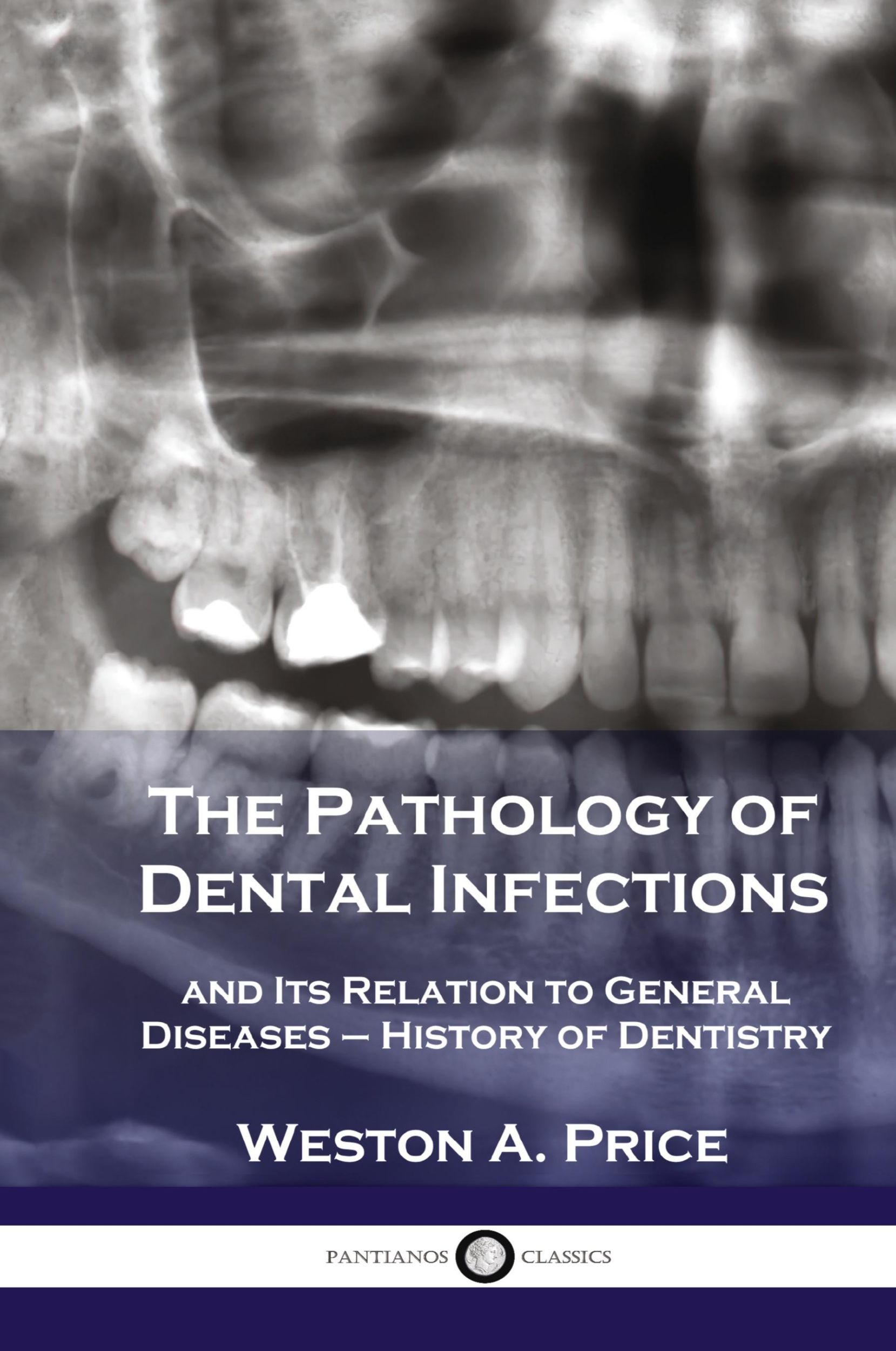 Cover: 9781789873672 | Pathology of Dental Infections | Weston A. Price | Buch | Englisch