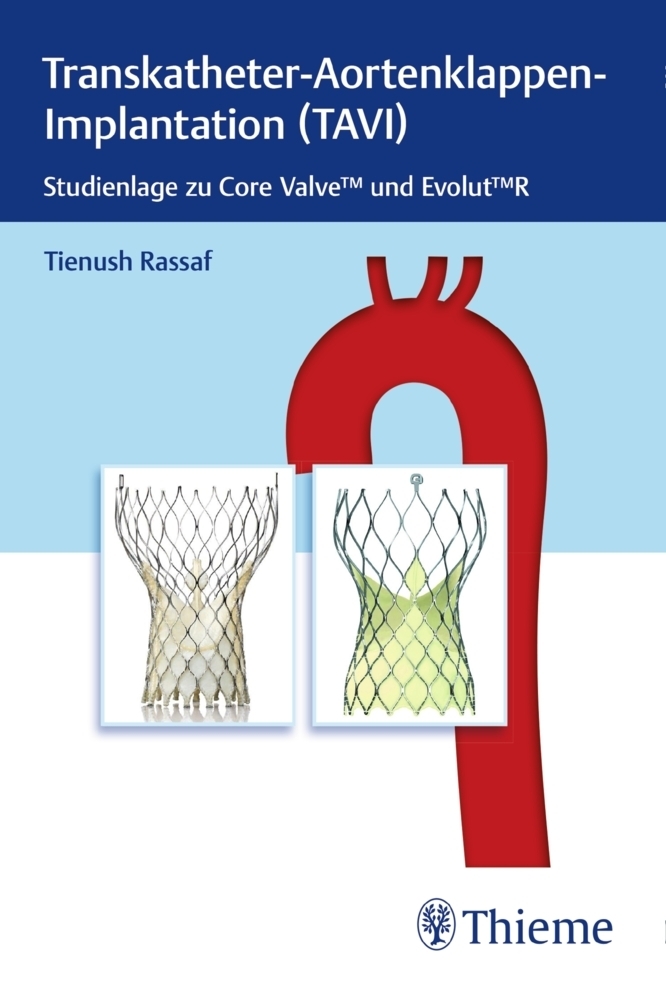 Cover: 9783132420144 | Transkatheter Aortenklappenimplantation (TAVI) | Tienush Rassaf | 2018