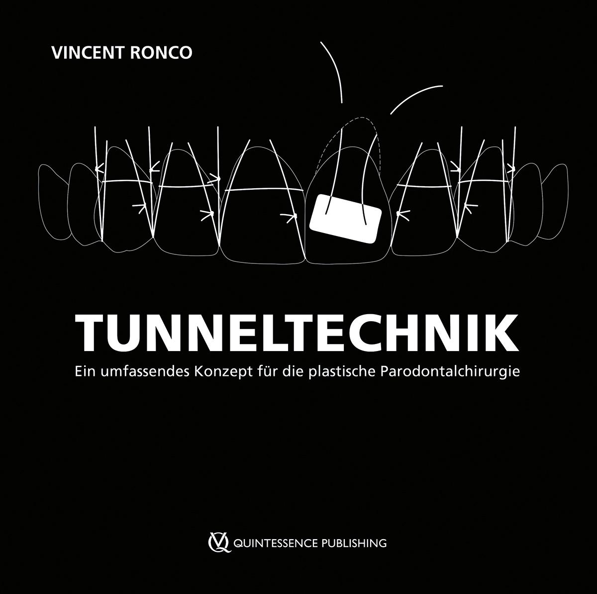 Cover: 9783868677188 | Tunneltechnik | Vincent Ronco | Buch | 304 S. | Deutsch | 2024