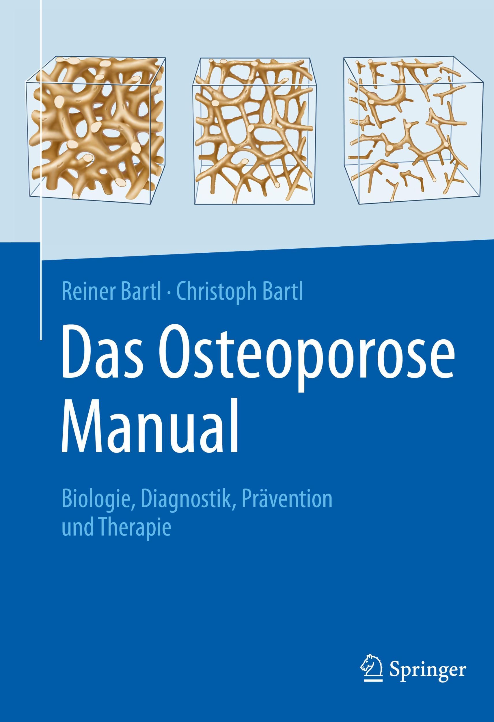 Cover: 9783662625279 | Das Osteoporose Manual | Biologie, Diagnostik, Prävention und Therapie