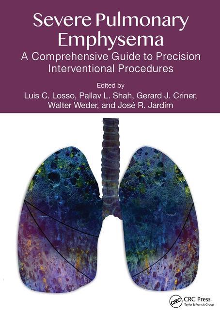 Cover: 9781032170237 | Severe Pulmonary Emphysema: | Gerald J. Criner (u. a.) | Taschenbuch