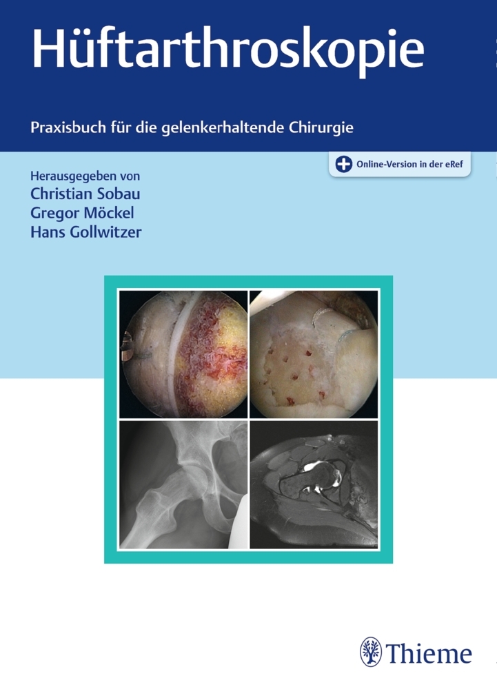 Cover: 9783132422155 | Hüftarthroskopie | Christian Sobau (u. a.) | Buch | 289 S. | Deutsch