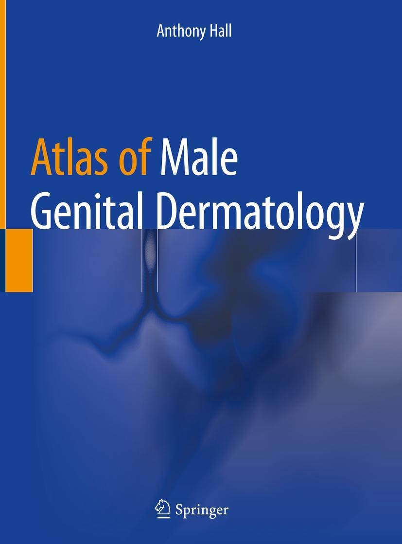 Cover: 9783319997490 | Atlas of Male Genital Dermatology | Anthony Hall | Buch | xviii | 2018