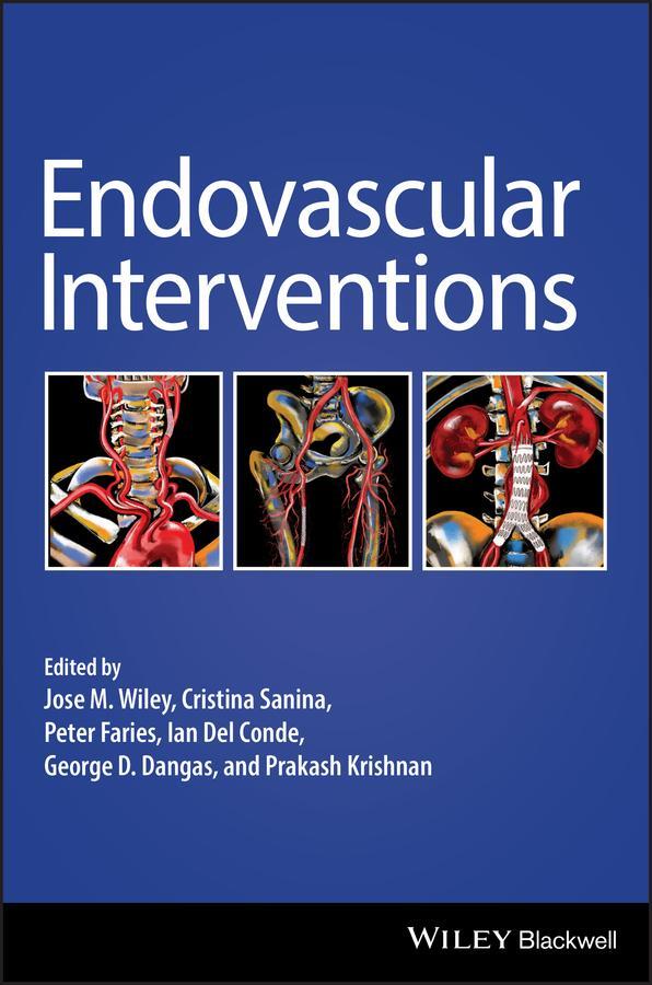 Cover: 9781119283492 | Endovascular Interventions | Jose M Wiley (u. a.) | Buch | 328 S.