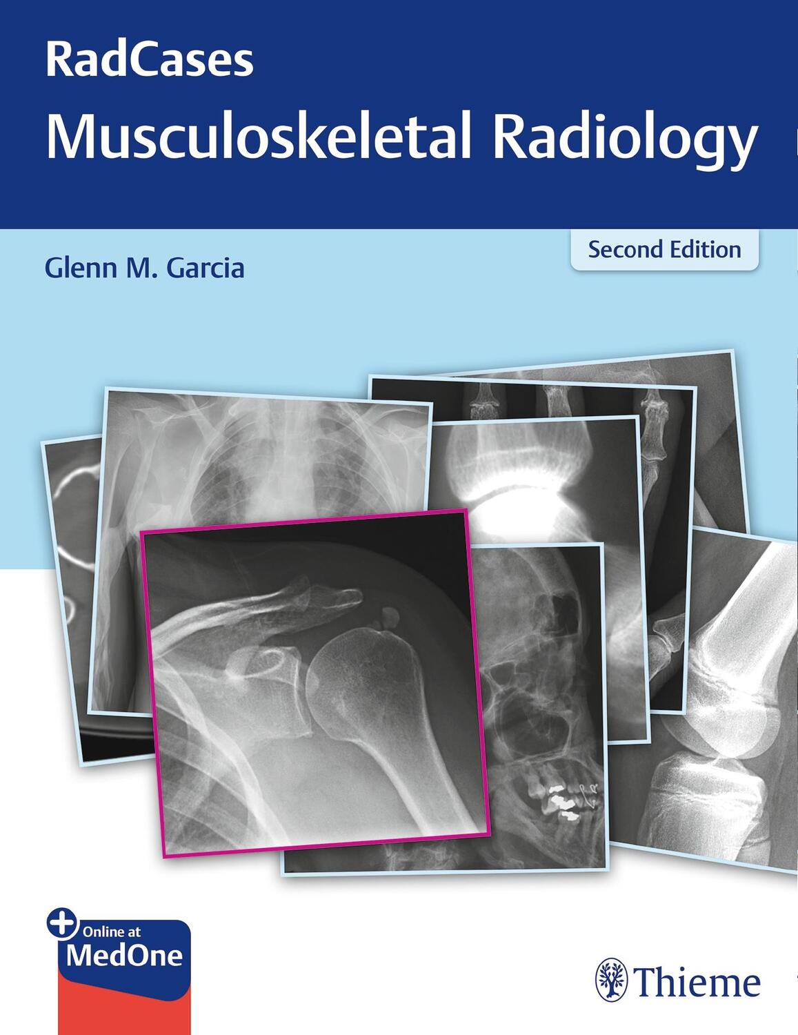 Cover: 9781626232440 | Radcases Q&amp;A Musculoskeletal Radiology | Glenn M Garcia | Taschenbuch