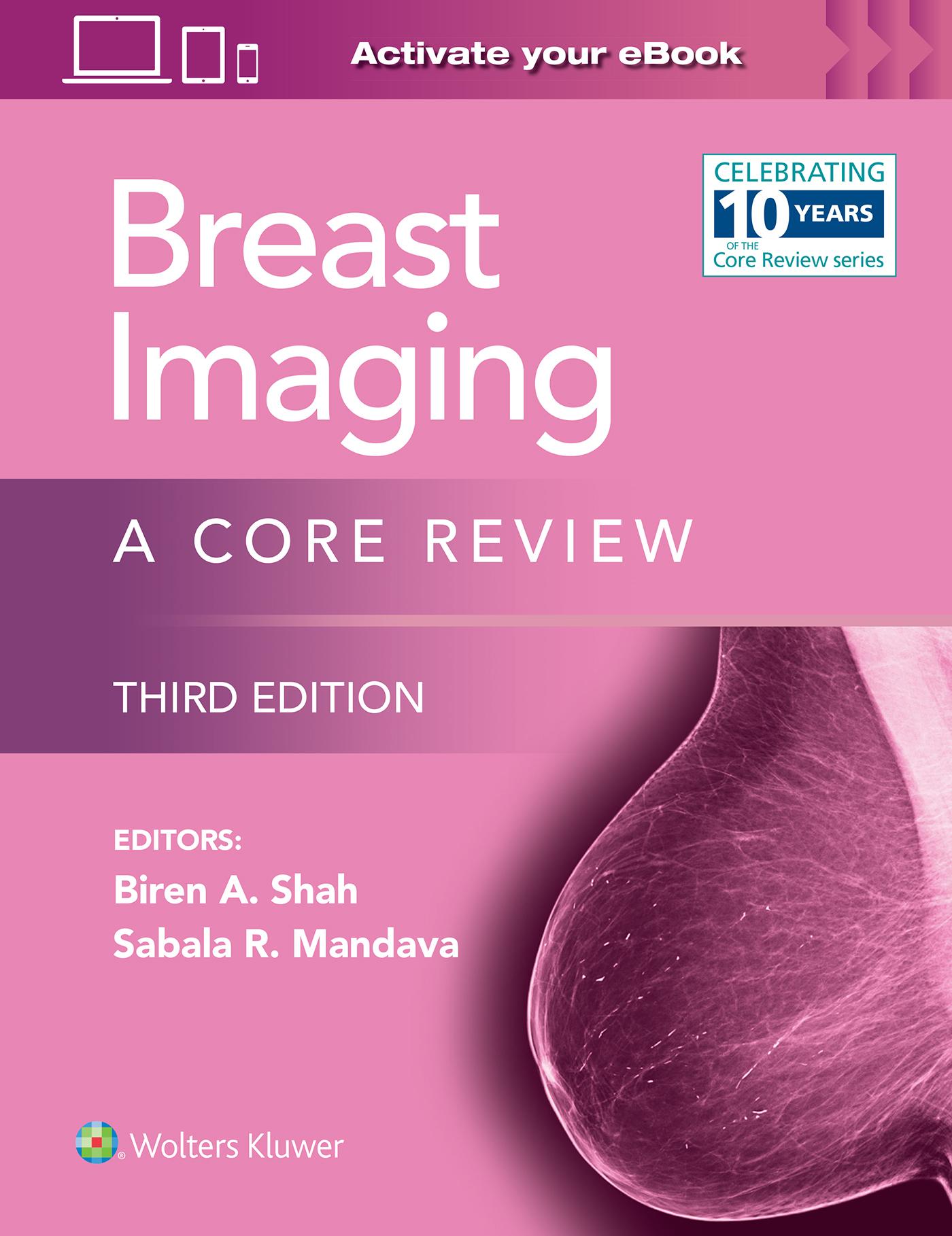 Cover: 9781975195687 | Breast Imaging | A Core Review: Print + eBook with Multimedia | Buch