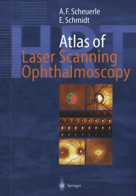 Cover: 9783642639210 | Atlas of Laser Scanning Ophthalmoscopy | Scheuerle (u. a.) | Buch