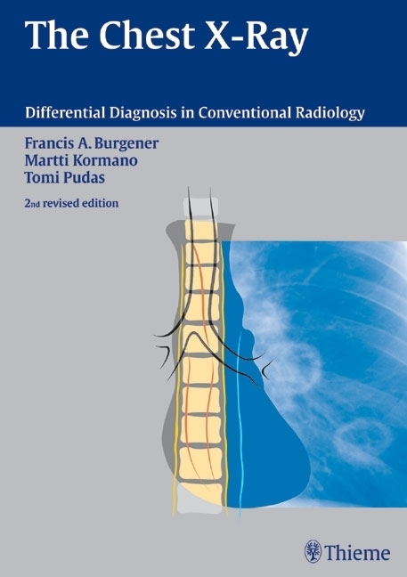 Cover: 9783131076120 | The Chest X-Rays | Differential Diagnosis in Conventional Radiology