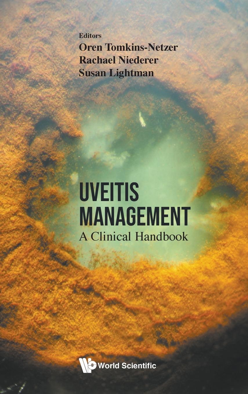 Cover: 9789811251467 | UVEITIS MANAGEMENT | A CLINICAL HANDBOOK | Tomkins-Netzer | Buch