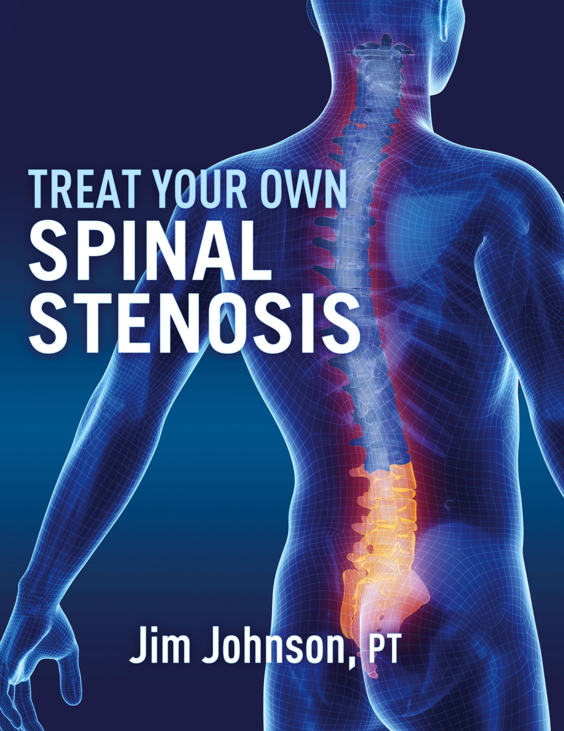 Cover: 9781642379587 | Treat Your Own Spinal Stenosis | Jim Johnson | Taschenbuch | Englisch