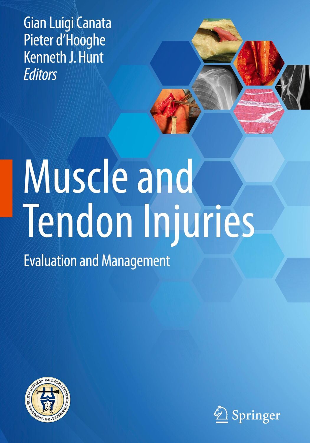 Cover: 9783662541838 | Muscle and Tendon Injuries | Evaluation and Management | Buch | xiii