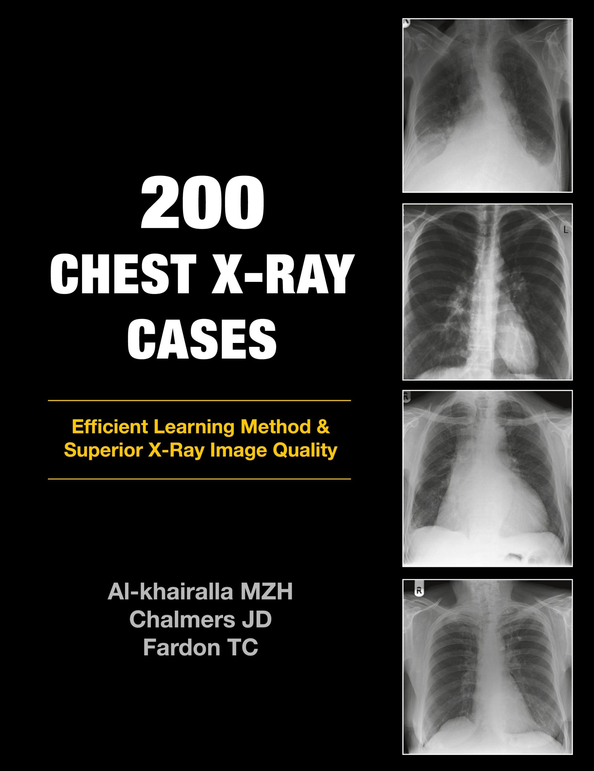 Cover: 9781905006366 | 200 Chest X-Ray Cases | Mudher Al-Khairalla (u. a.) | Taschenbuch