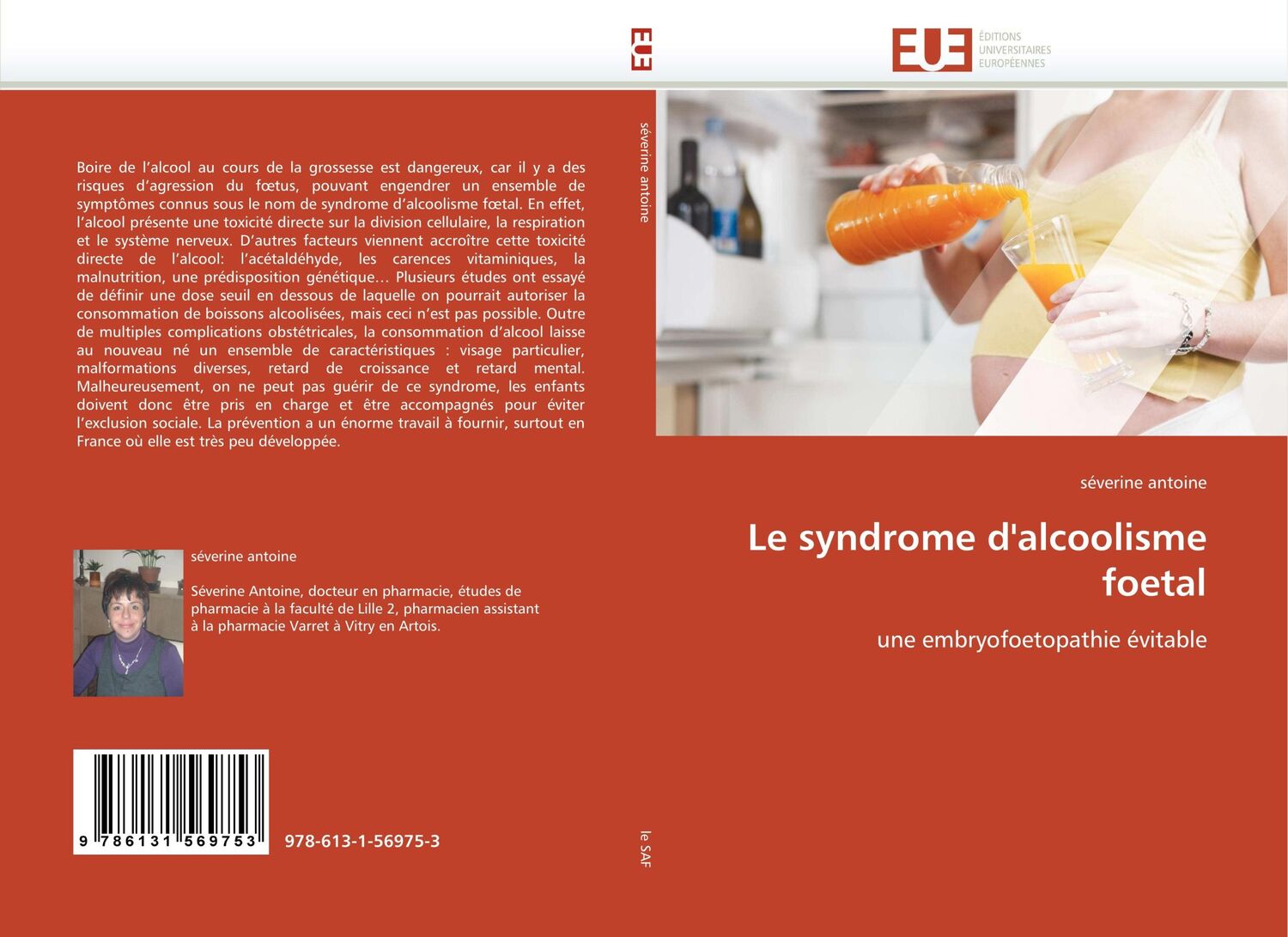 Cover: 9786131569753 | Le syndrome d'alcoolisme foetal | une embryofoetopathie évitable