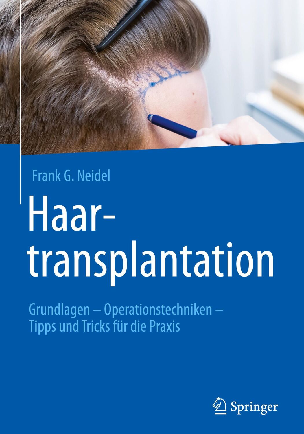 Cover: 9783662648520 | Haartransplantation | Frank G. Neidel | Buch | x | Deutsch | 2022